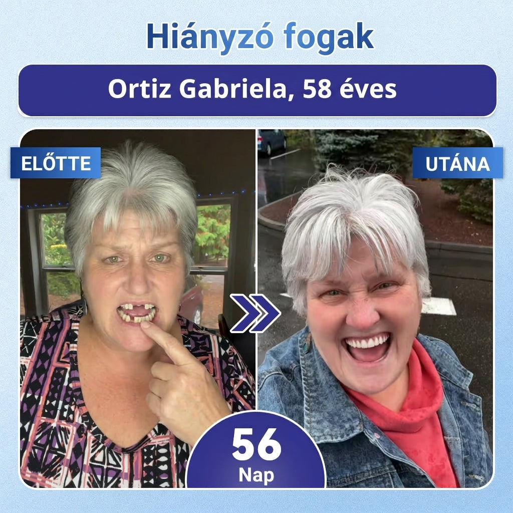 🇭🇺🦷 Mondj búcsút az érzékenységnek és kellemetlenségeknek! 𝐂𝐨𝐚𝐮𝐨𝐨® Tideglusib szájcsíkok – gyors regenerálás a fogaknak és az ínynek 😊