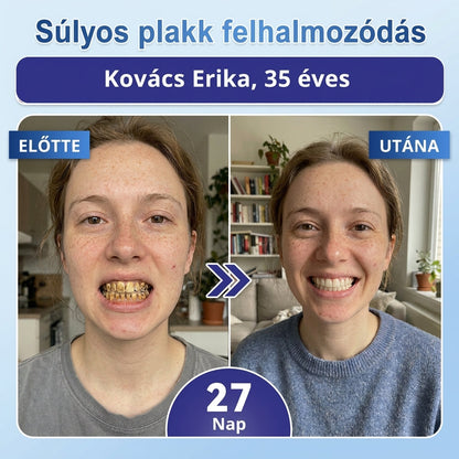 🇭🇺🦷 Mondj búcsút az érzékenységnek és kellemetlenségeknek! 𝐂𝐨𝐚𝐮𝐨𝐨® Tideglusib szájcsíkok – gyors regenerálás a fogaknak és az ínynek 😊