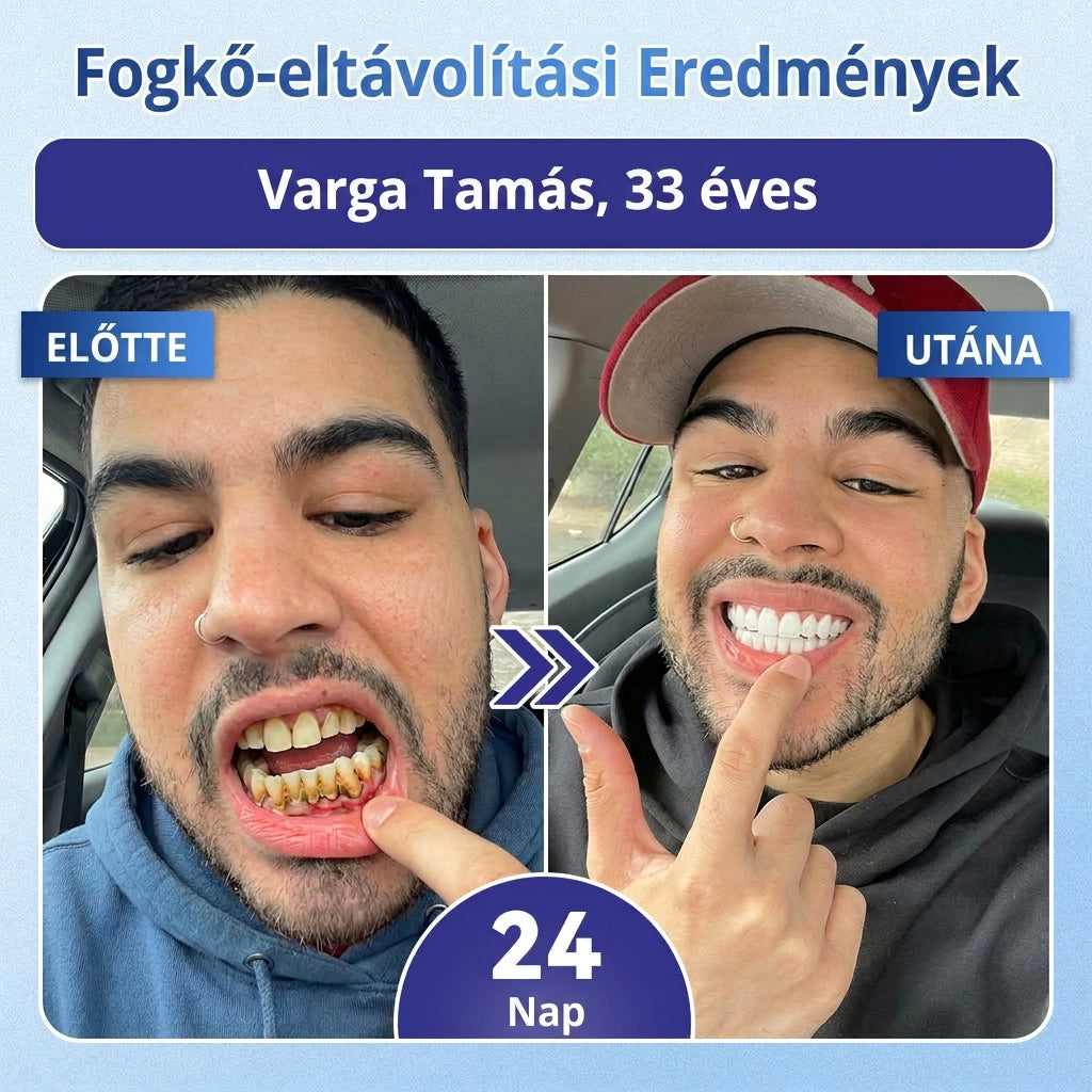 🇭🇺🦷 Mondj búcsút az érzékenységnek és kellemetlenségeknek! 𝐂𝐨𝐚𝐮𝐨𝐨® Tideglusib szájcsíkok – gyors regenerálás a fogaknak és az ínynek 😊