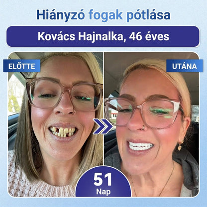 🇭🇺🦷 Mondj búcsút az érzékenységnek és kellemetlenségeknek! 𝐂𝐨𝐚𝐮𝐨𝐨® Tideglusib szájcsíkok – gyors regenerálás a fogaknak és az ínynek 😊